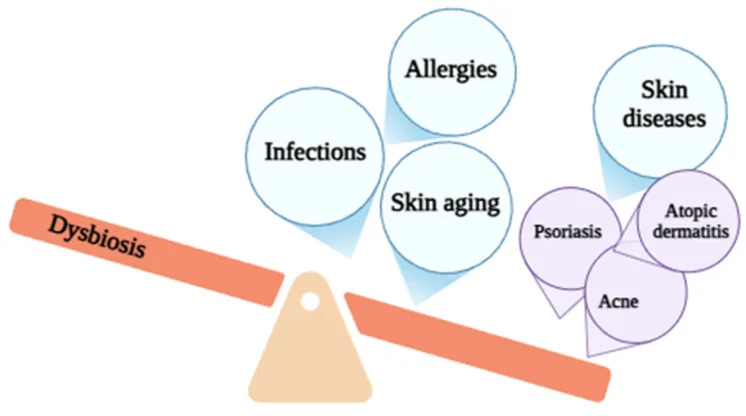 Diagram showing that an imbalance of skin microbes is linked with infections, allergies, skin ageing and skin diseases including acne, which overusing an antiseptic for acne may encourage