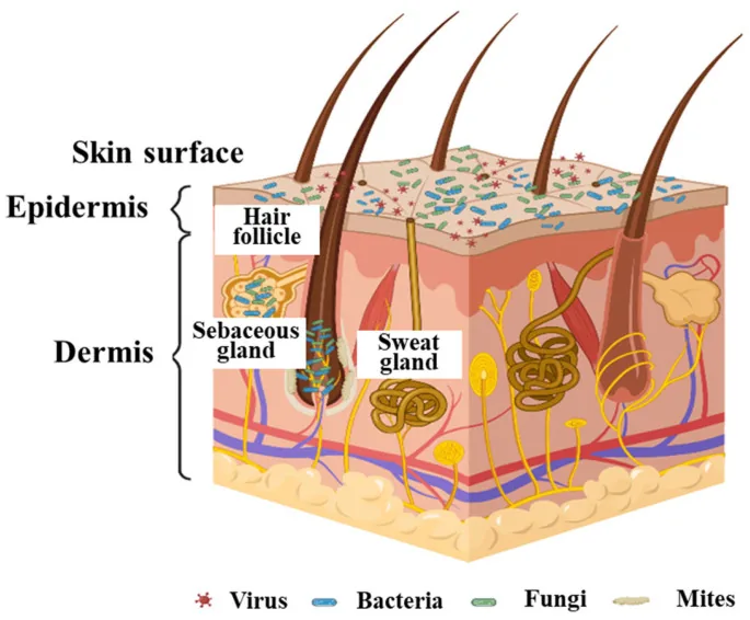 Diagram of the skin layers showing bacteria and fungi on the surface and inside a hair follicle next to the oil gland, where an antiseptic for acne struggles to reach