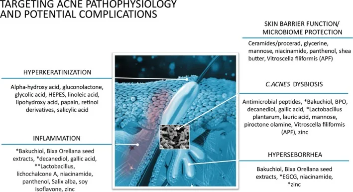 Diagram grouping acne-treatment ingredients by what they target: blocked follicles, inflammation, excess oil, bacteria and the skin barrier, to help you choose the best serum for acne