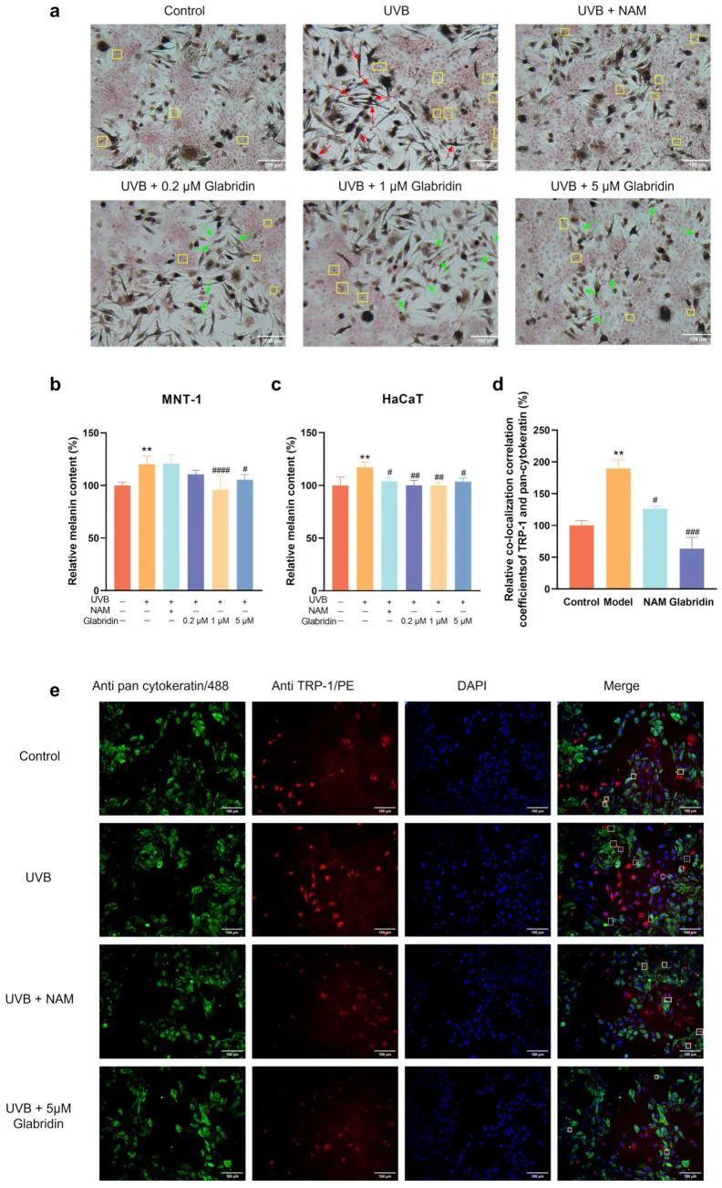 Microscope images and charts from a laboratory study on pigment cells and skin cells showing glabridin reducing pigment production and transfer, the second ingredient in Alpha Plus lightening cream