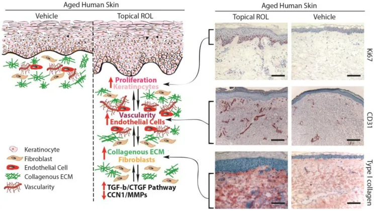 Diagram and tissue sections from aged human skin comparing topical retinol with the vehicle, showing more collagen, vessels and cell proliferation, the strongest ingredient in the best serum for wrinkles