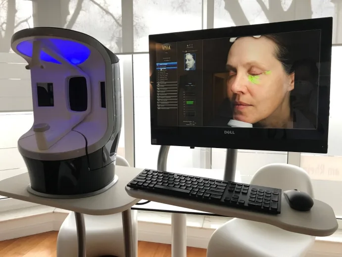 A skin-imaging cabinet and a screen showing a participant's face with the crow's feet marked, from a study of Argireline as a Botox alternative for wrinkles