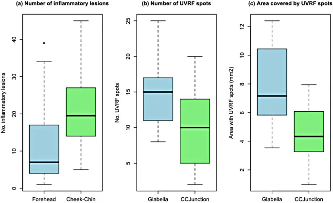 Box plots showing more inflammatory spots on the cheeks and chin than on the forehead in mask wearers