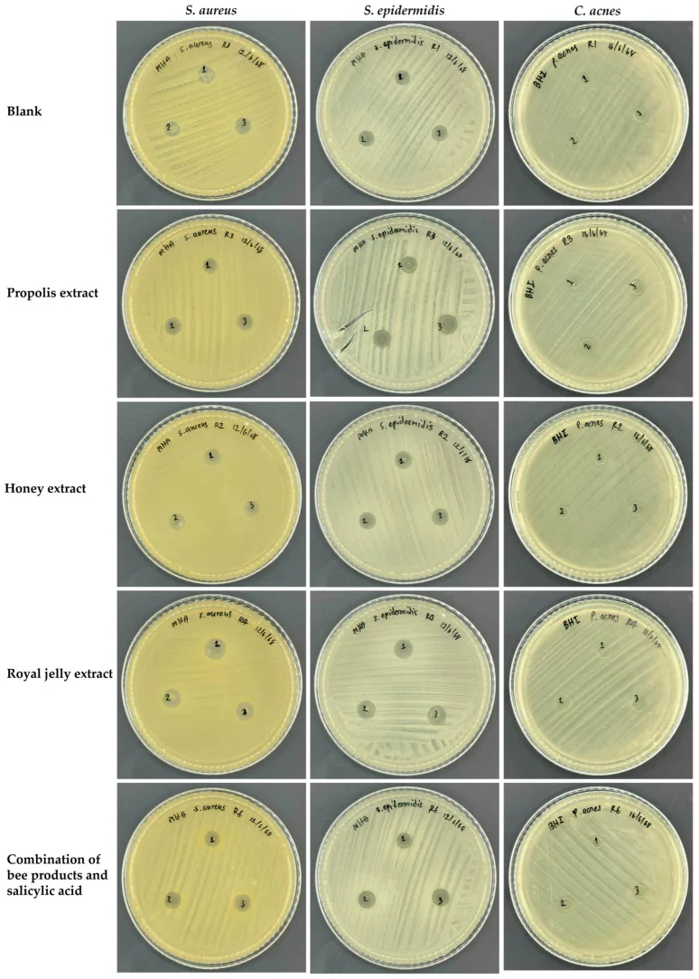 Lab plates of skin bacteria and acne bacteria with propolis, honey and royal jelly extracts and their combination with salicylic acid, showing zones where growth was inhibited, laboratory rather than clinical evidence on honey for acne