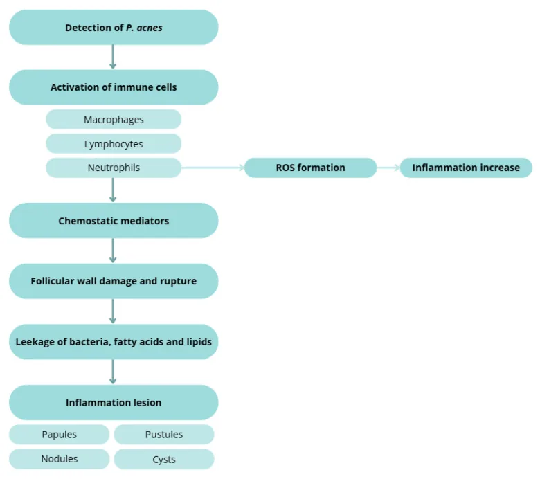 Flowchart of the inflammatory sequence: detection of bacteria, activation of immune cells, damage and rupture of the pore wall, then papules, pustules, nodules and cysts