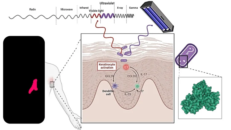 Illustration of erythrasma bacteria in the outer layer of the skin and their coral-red glow under ultraviolet light, which distinguishes them from ordinary inner thigh darkening
