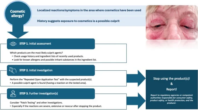 Flowchart of steps for suspected cosmetic allergy: assessing products, then a repeated open application test, then patch testing, with a photo of red eyelids, which applies to natural masks too
