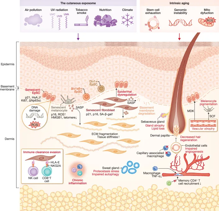 Cross-section of aged skin showing how ultraviolet light, pollution and tobacco smoke combine with internal ageing to fragment collagen, among the causes of a sagging face